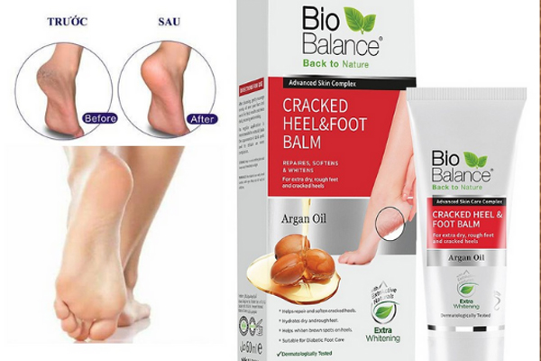 Kem bôi làm mềm gót chân trị nứt gót chân hiệu quả Bio Balance